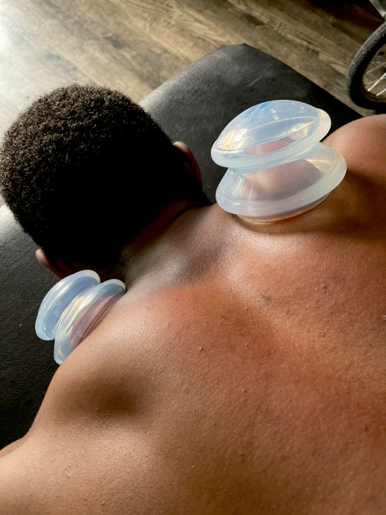 cupping!
