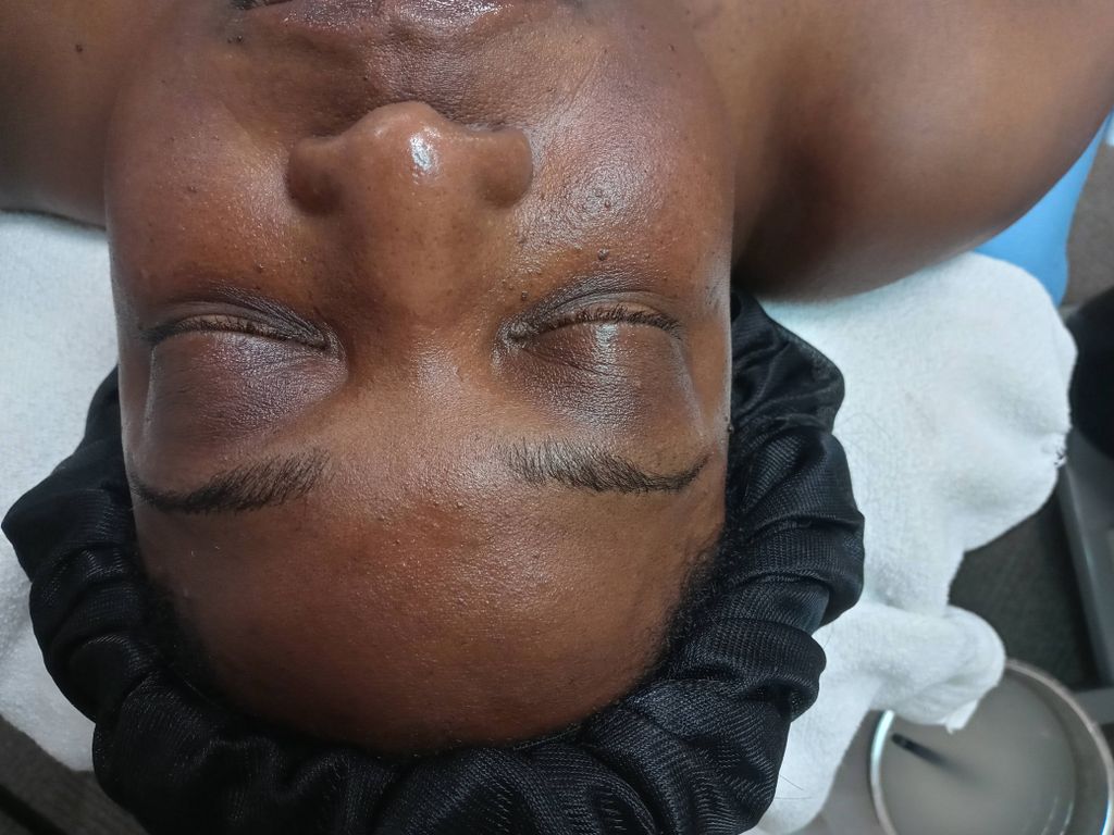 Before Passion Peel and Brows & Lashes