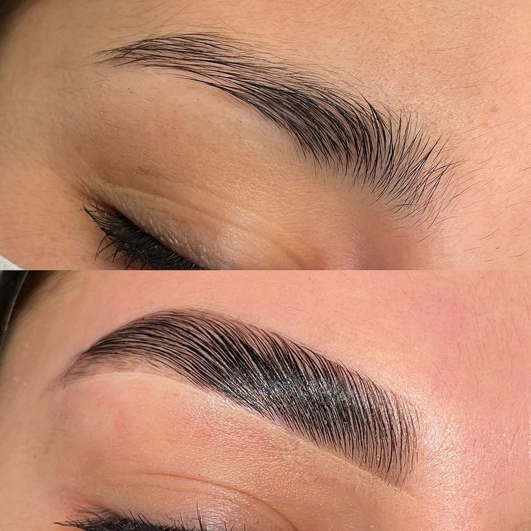Brow Lamation