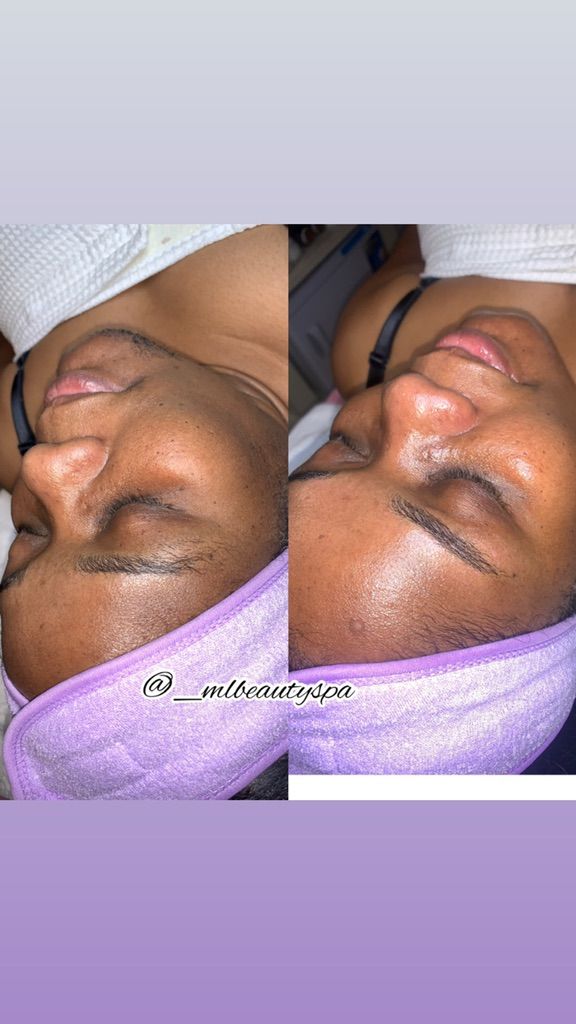 Vitamin C brightening facial