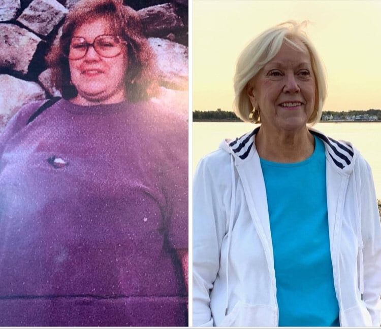 Before/After