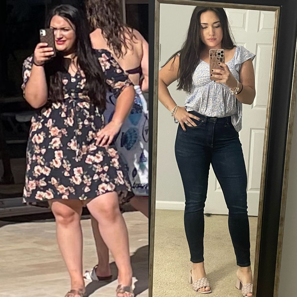 Before/ After