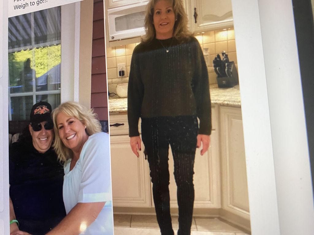 Before/After