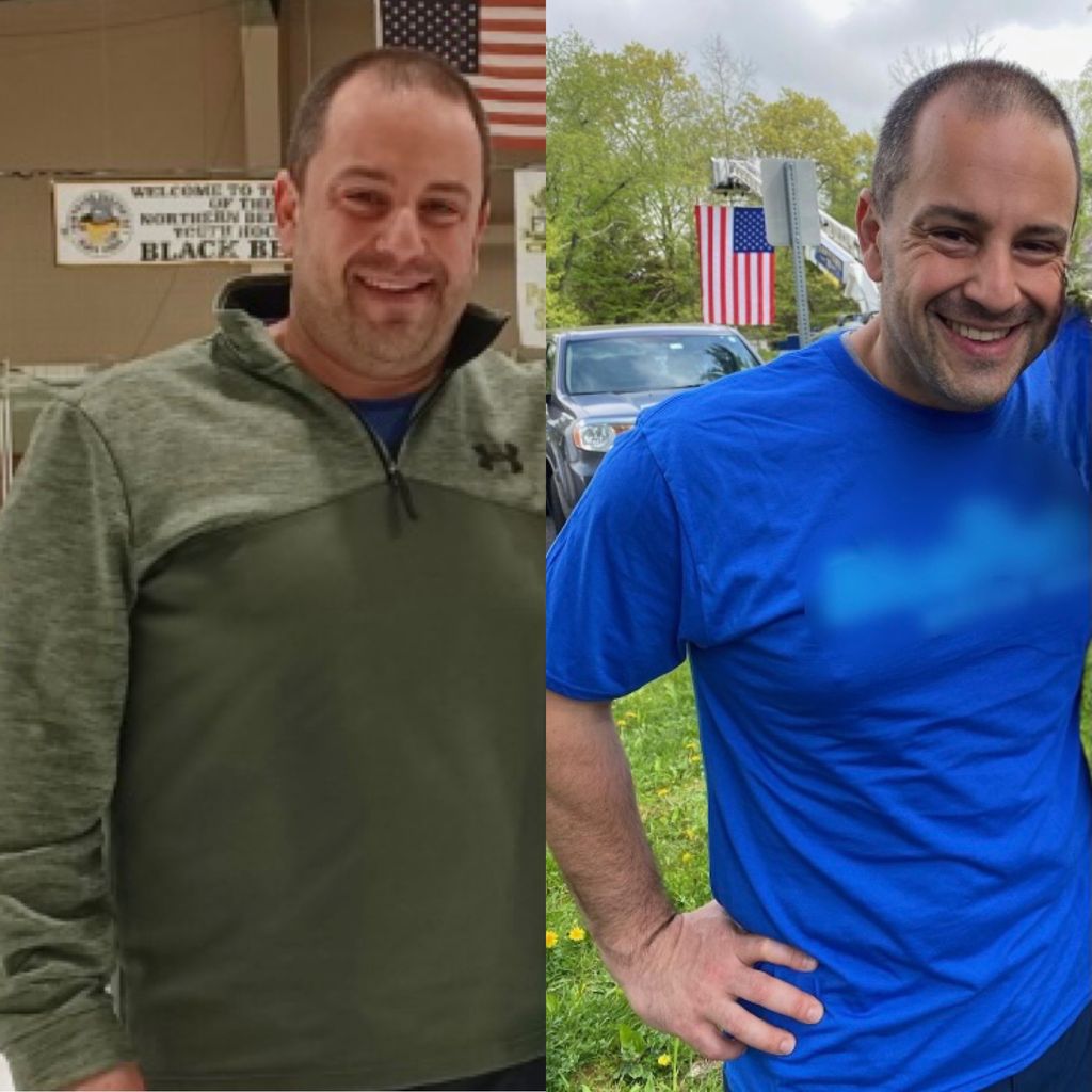 Before/After