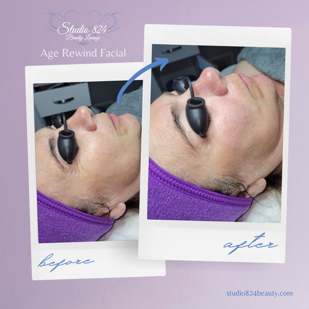 Age rewind facial