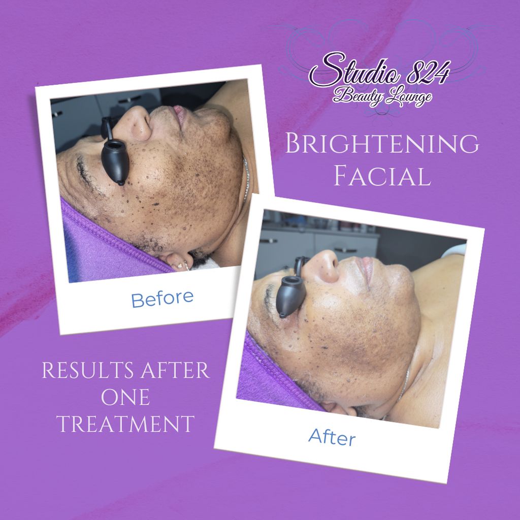 Brightening facial