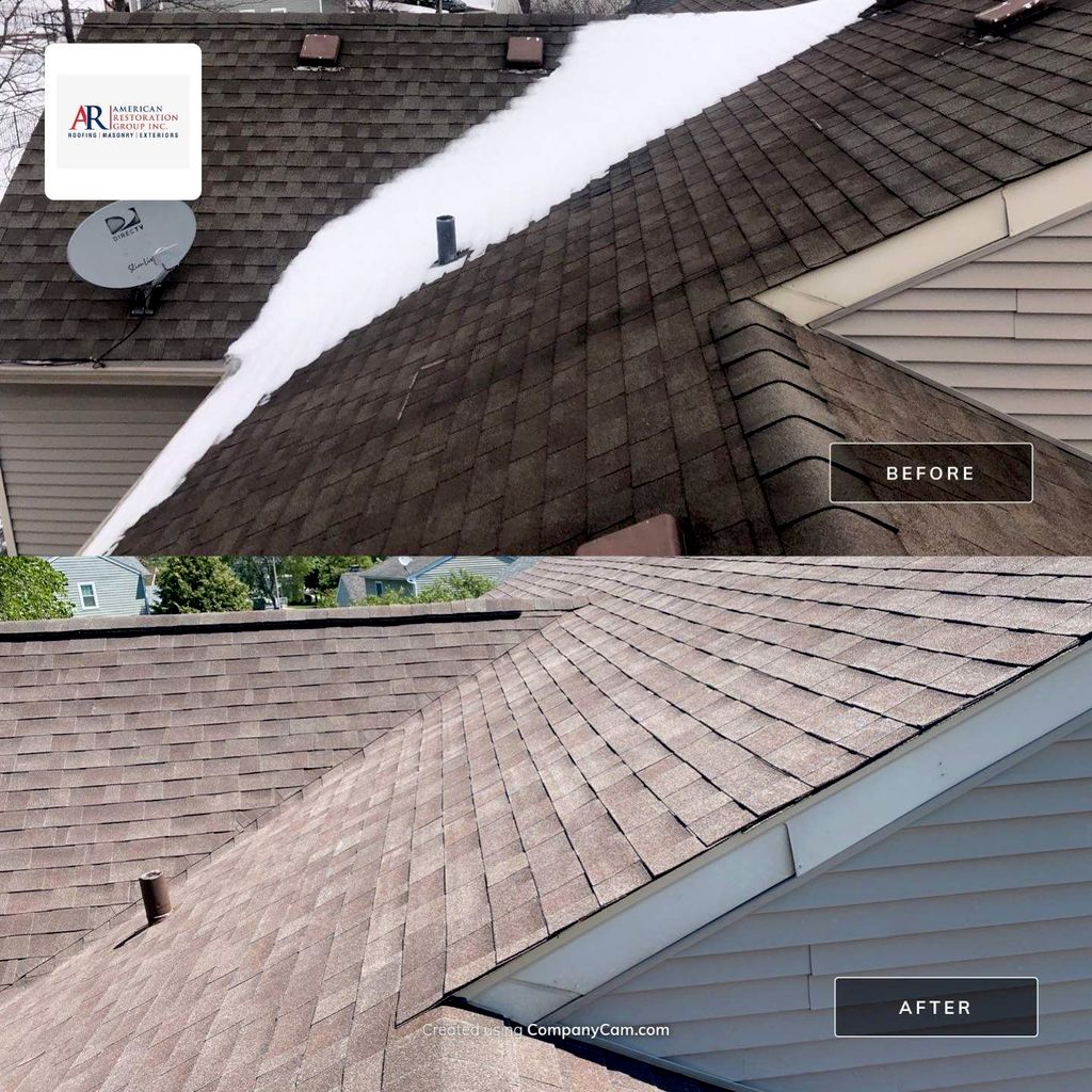 Shingles Before and After