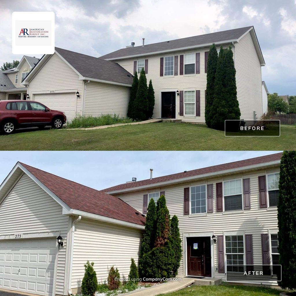 Shingles Before and After