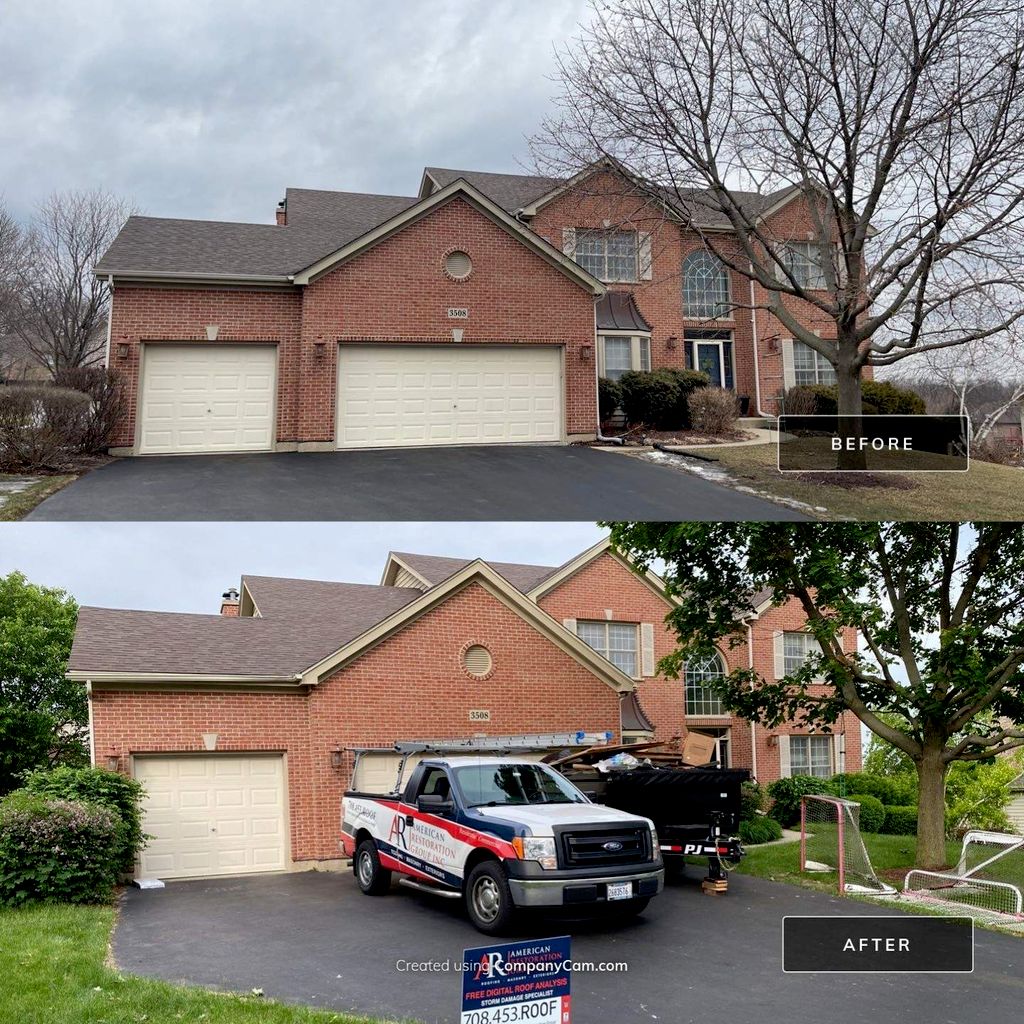 Shingles Before and After