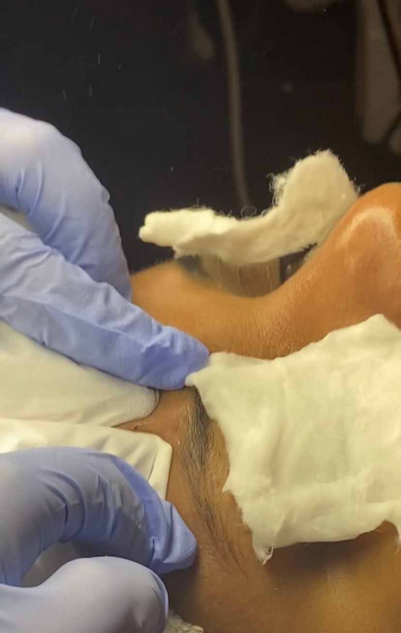 Manual extractions 
