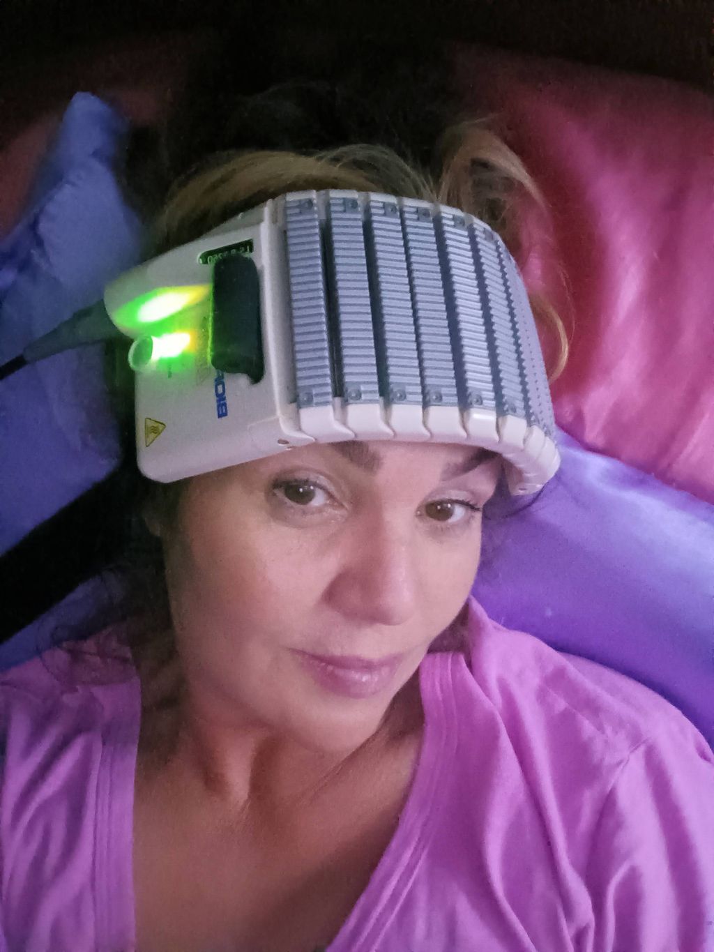 Bioflex Laser Treatment 