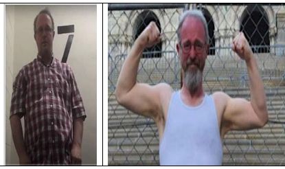 My Before and After Photos