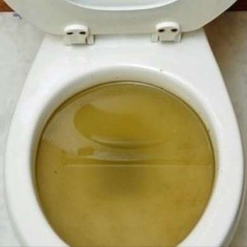 Toilet drain clogs 