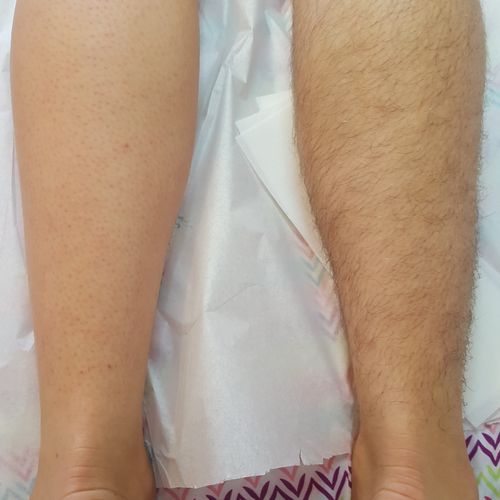 Before and after leg wax