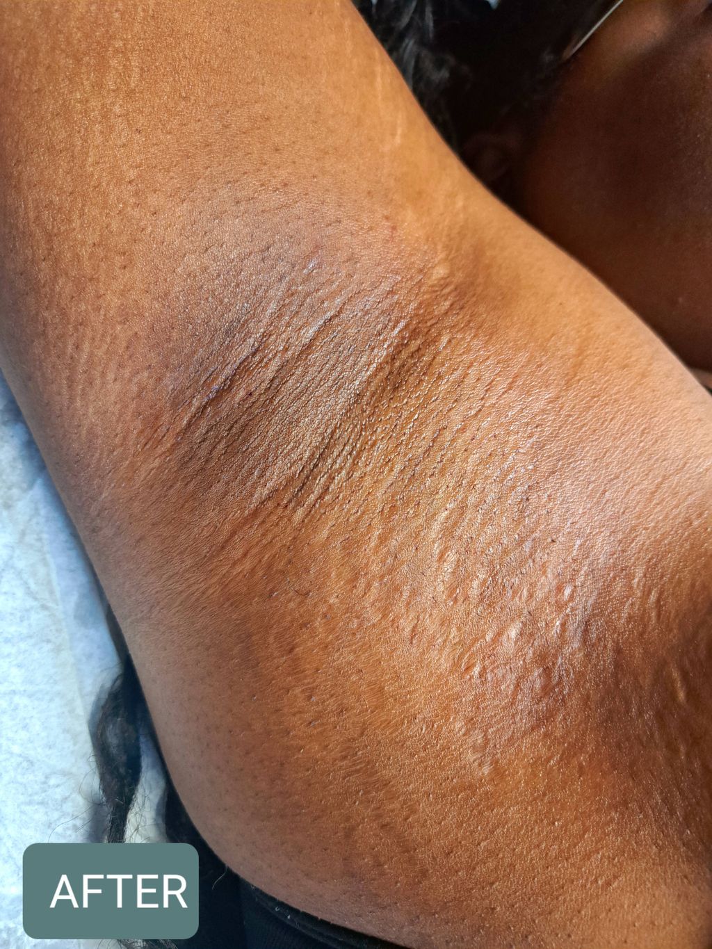AFTER under arm wax