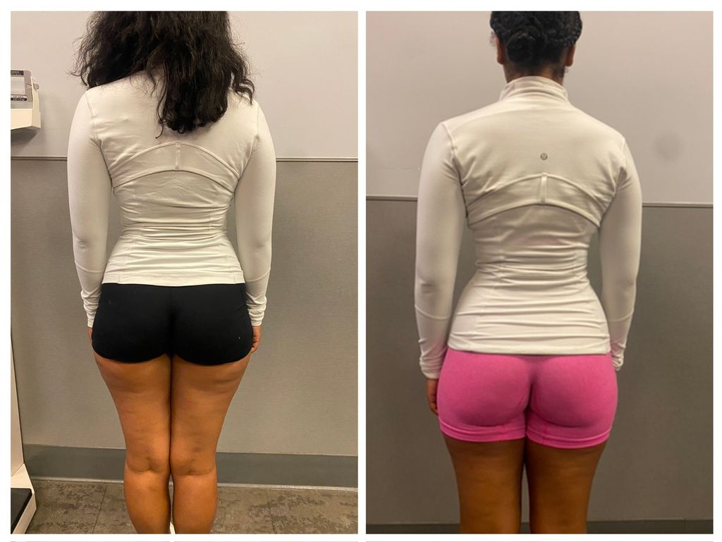 Black shorts - before 
Pink shorts - after 

15 se