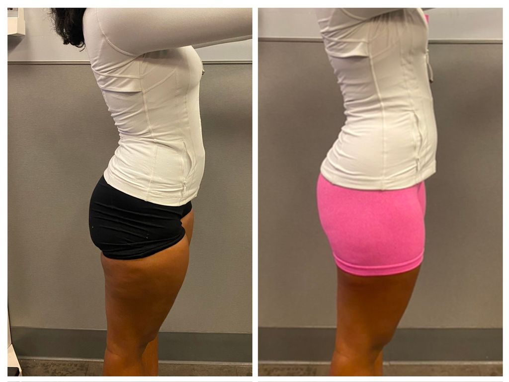 Black shorts - before 
Pink shorts - after 

15 se