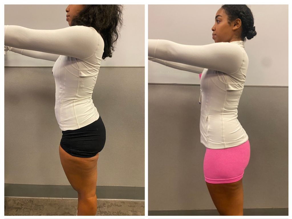 Black shorts - before 
Pink shorts - after 

15 se