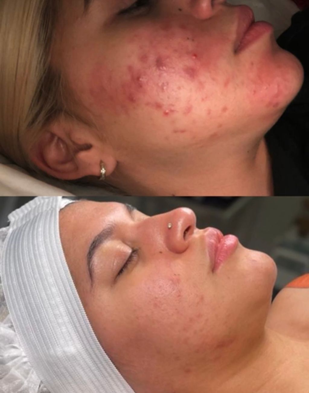 Deep  Clarifying Facial 