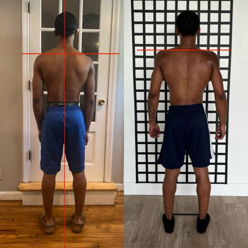 13 Month Posture result