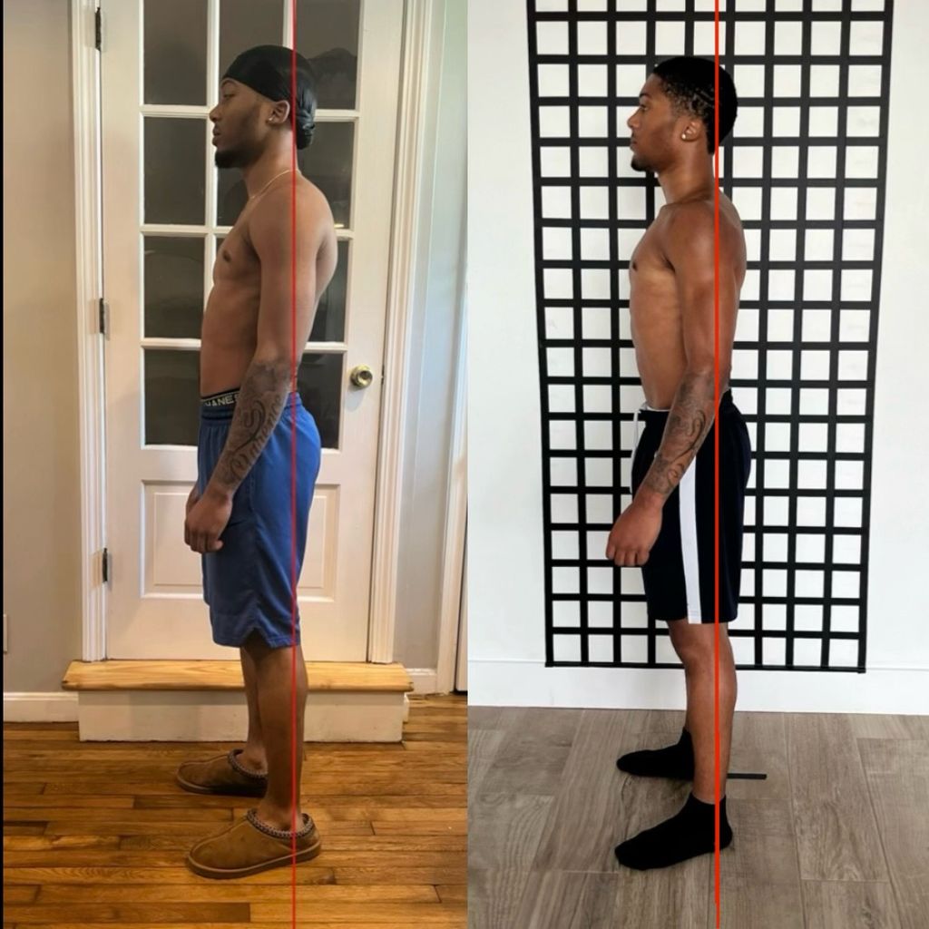 13 Month Posture result