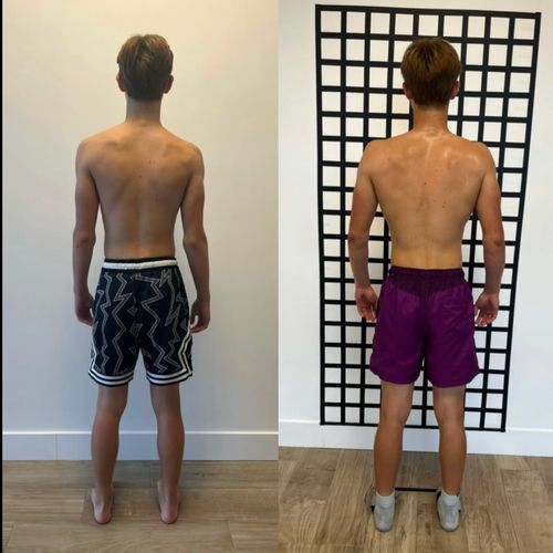 14 Month Posture result