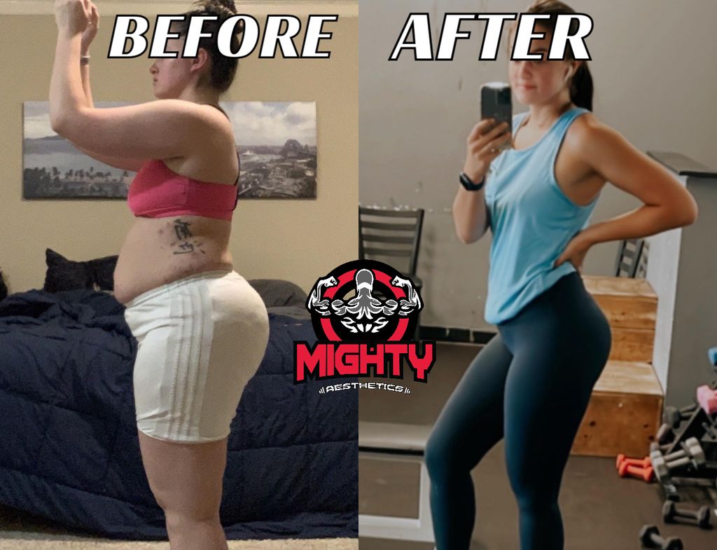 Post pregnancy coma back 💪