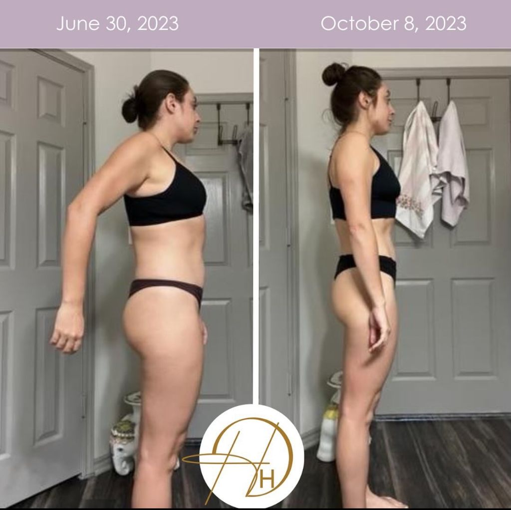 Caroline's Before and After