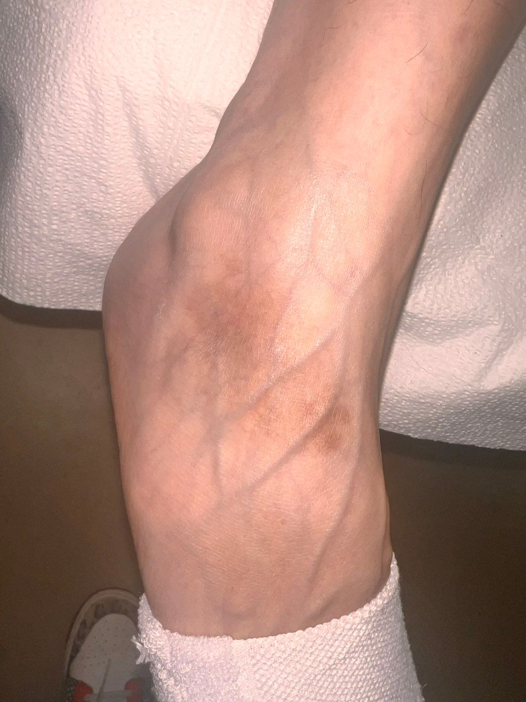 Before Treatment Number 3 after treatment number 2