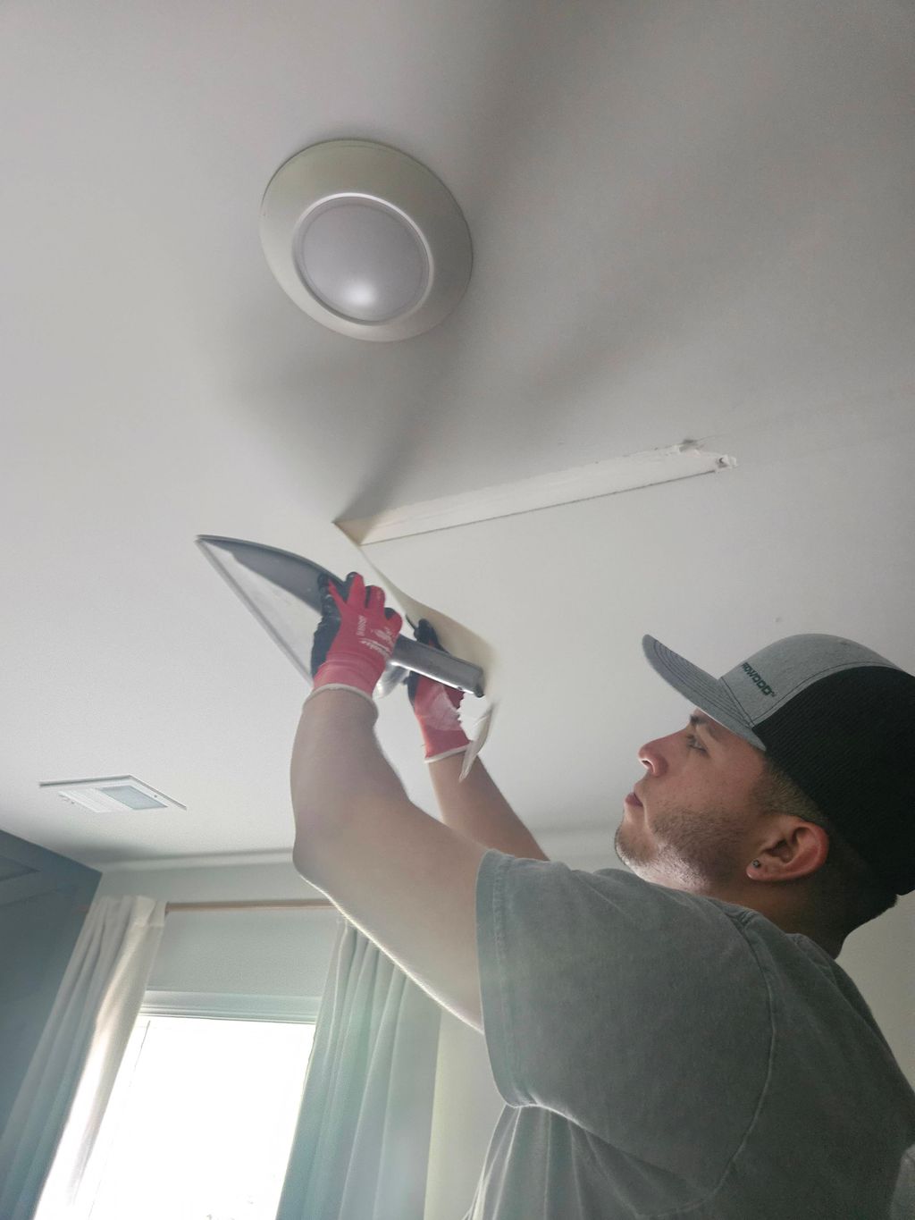 Removal of the tape 
