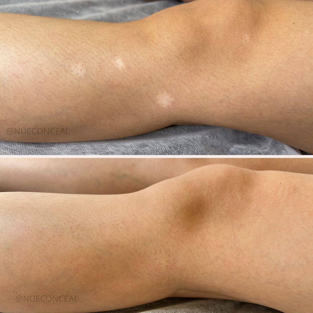 Scar camouflage before and after